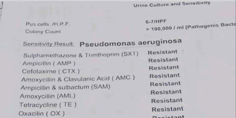 What Is Drug Resistance Tb